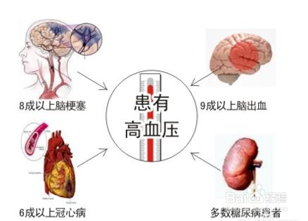 高血壓的形成原因如何預防高血壓