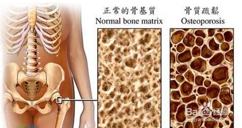 中老年人體檢專案有哪些？