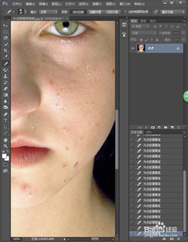 如何利用Photoshop去除面部痘痘