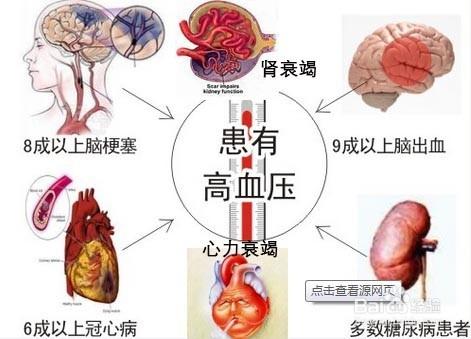 高血壓危害可引起器髒損傷 運動預防是關鍵