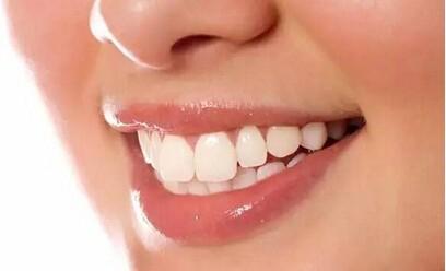 如何讓牙齒快速美白？
