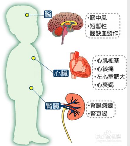 降壓之計在於晨