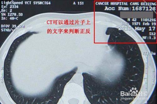 如何用手機拍照醫院檢查的影像片子