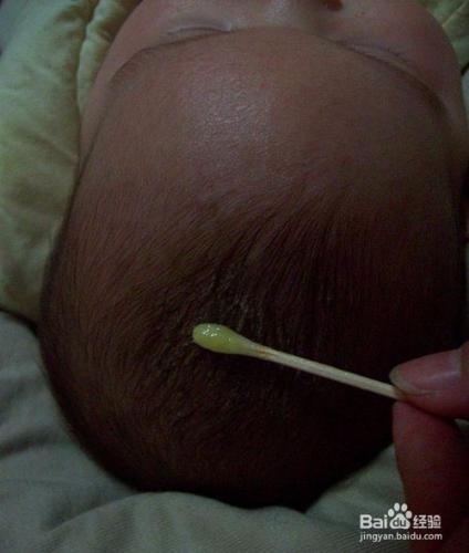 如何簡單去除寶寶頭上的乳痂