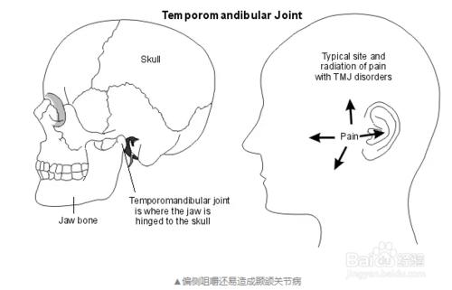 容易 ＂咬＂出口腔疾病影響咀嚼肌的偏側咀嚼