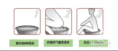 慢性前列腺炎症怎麼辦