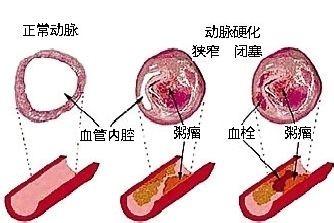 晚餐決定你的體重和壽命