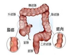 晚餐決定你的體重和壽命