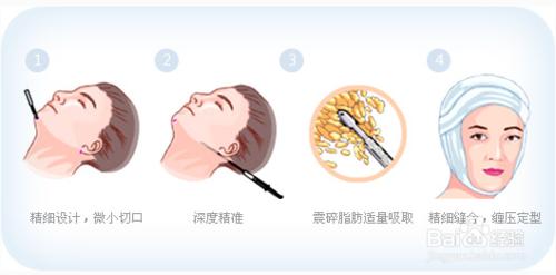 不同面部情況要達到瘦臉目的對應的不同方法