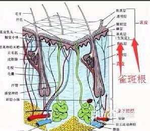 去雀斑用什麼方法最徹底