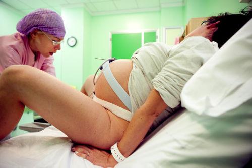 分娩過程中醫生會做的12件事