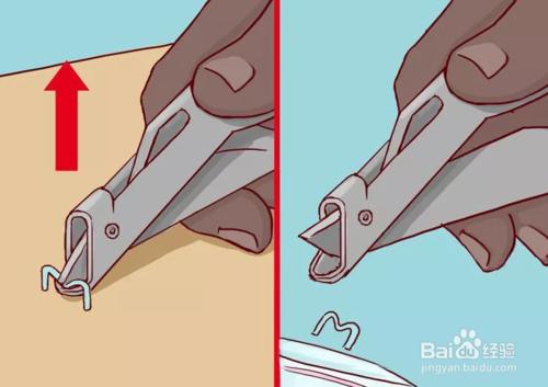 用醫用釘皮機進行傷口閉合後，怎麼拆釘？